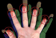 醫(yī)療器械唯一標識UDI